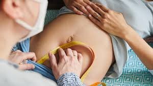 Wenn die Betäubung beim Kaiserschnitt versagt